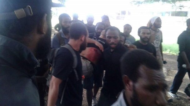 PNG police allegedly open fire on unarmed students