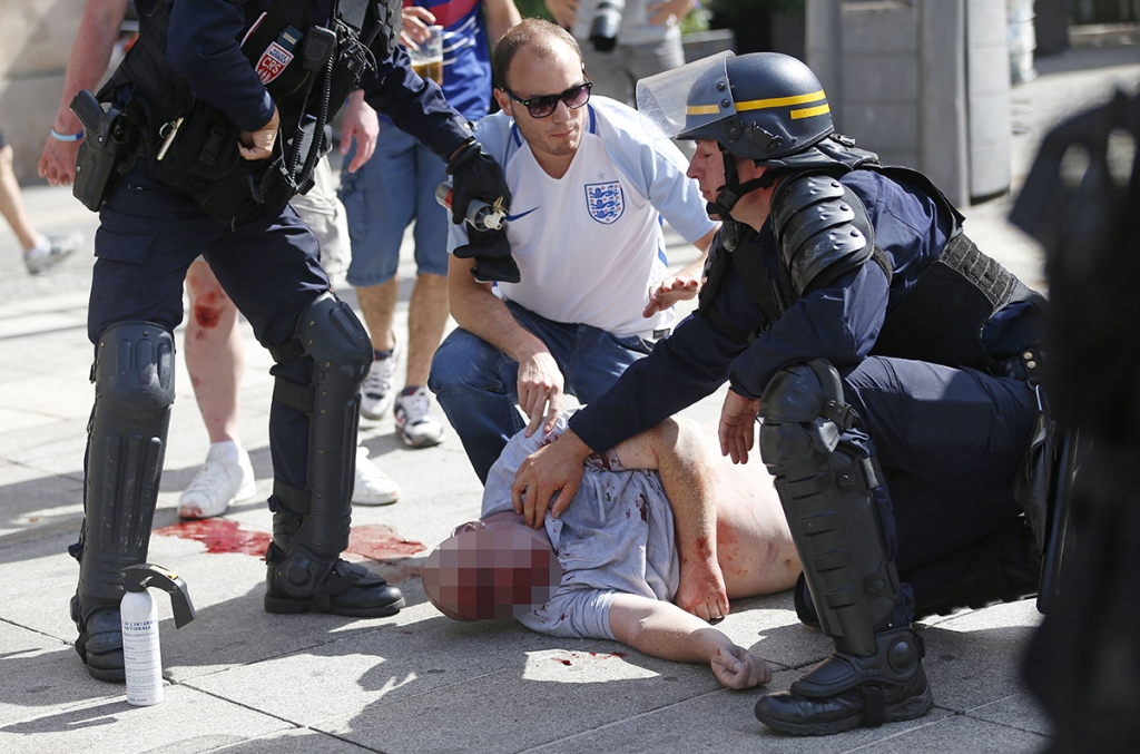 England fan fighting for his life after violent clashes with Russian fans