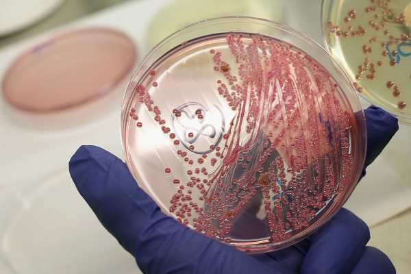 US reported its first case of last resort antibiotic resistant bacteria