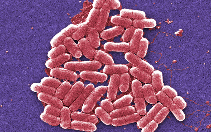 This 2006 colorized scanning electron micrograph image made available by the Centers for Disease Control and Prevention shows the O157:H7 strain of the E. coli bacteria. On Wednesday