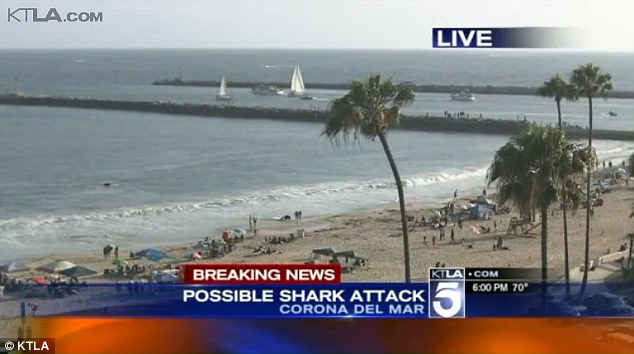 Lifeguards shut down a popular Southern California beach for swimmers and surfers after a woman was pulled injured from the water with bite marks in a possible shark attack authorities said