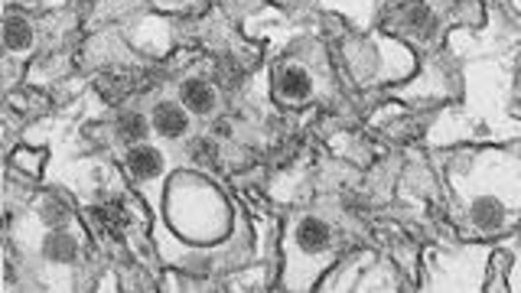 A microscope image of the Zika virus