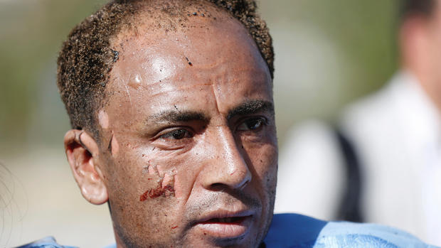 An injured man arrives for treatment outside a hospital after a suicide attack in Kabul Afghanistan