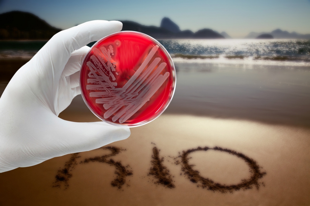 Will ‘superbug’ in Rio’s waters harm Olympic athletes