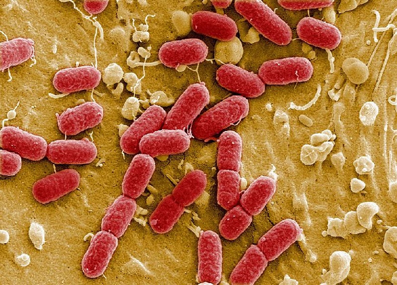 Q&A: Superbug precursor found in US again