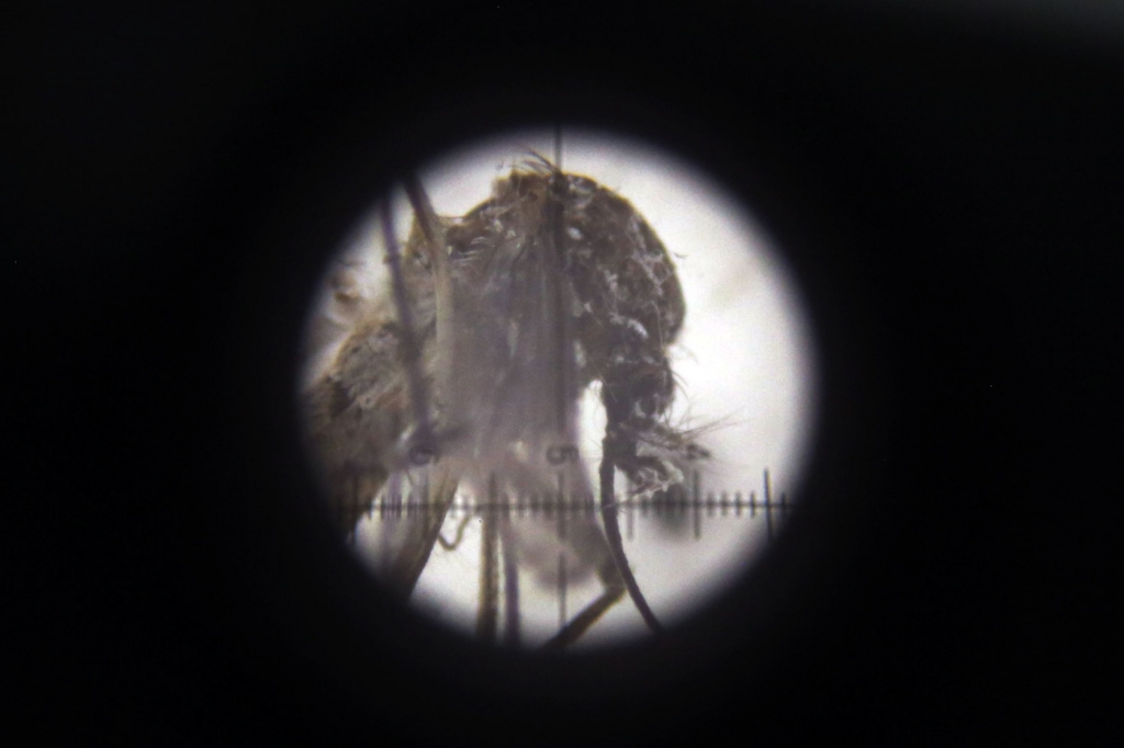 Aedes aegypti mosquito is seen through a microscope at Colombia's National Institute of Health in Bogota Colombia