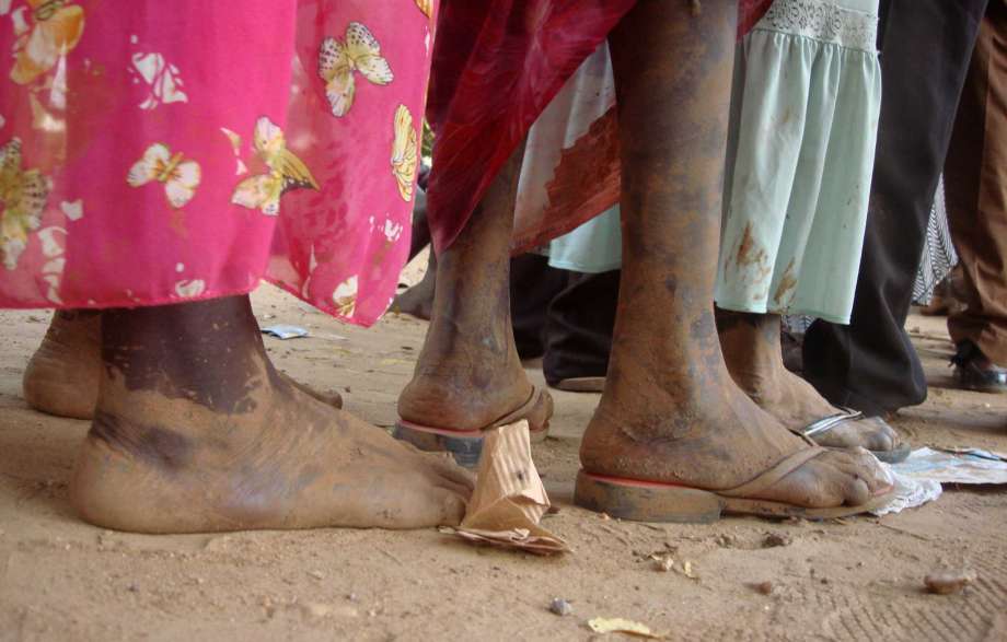 14 2016 and released by the United Nations Mission in South Sudan, people queue at the UN camp in Juba South Sudan. Some South Sudanese even those with dual U.S. citizenship are not being allowed to leave