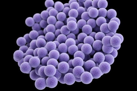 A cluster of methicillin-resistant Staphylococcus aureus bacteria. MRSA can cause skin infections blood stream infections and pneumonia