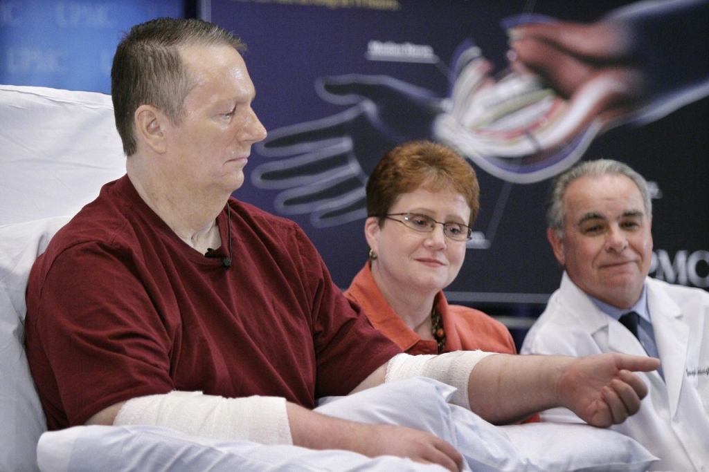 Hand Transplant Recipient Regrets Having Surgery