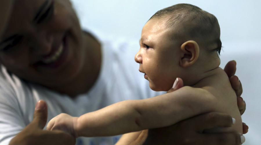 Therapist Rozely Fontoura holds Juan Pedro who has microcephaly in Recife Brazil