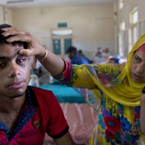 Tabish Bhat,16 whose eye was damaged after Indian government forces fired pellets at him during a protest shows his damaged eye as he rests on a hospital bed in Srinagar Indian controlled Kashmir Wednesday