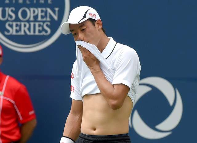 Jul 29 2016 Toronto Ontario Canada Kei Nishiikori of Japan reacts to missing a shot against Grigor Dimitrov of Bulgaria on day five of the Rogers Cup tennis tournament at Aviva Centre. Nishikori won 6-3 3-6 6-2. Mandatory Credit Dan Hamilton-USA T