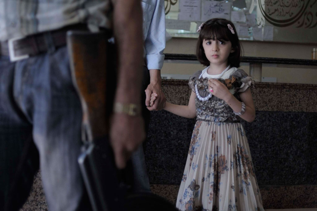 A girl who fell and struck her head in her home awaits medical examination at Dar El Shifa Hospital in Aleppo Syria