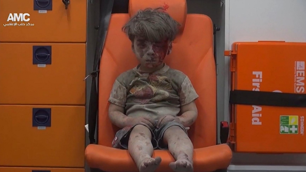 Russia Denies Involvement in Aleppo Attack That Wounded Boy