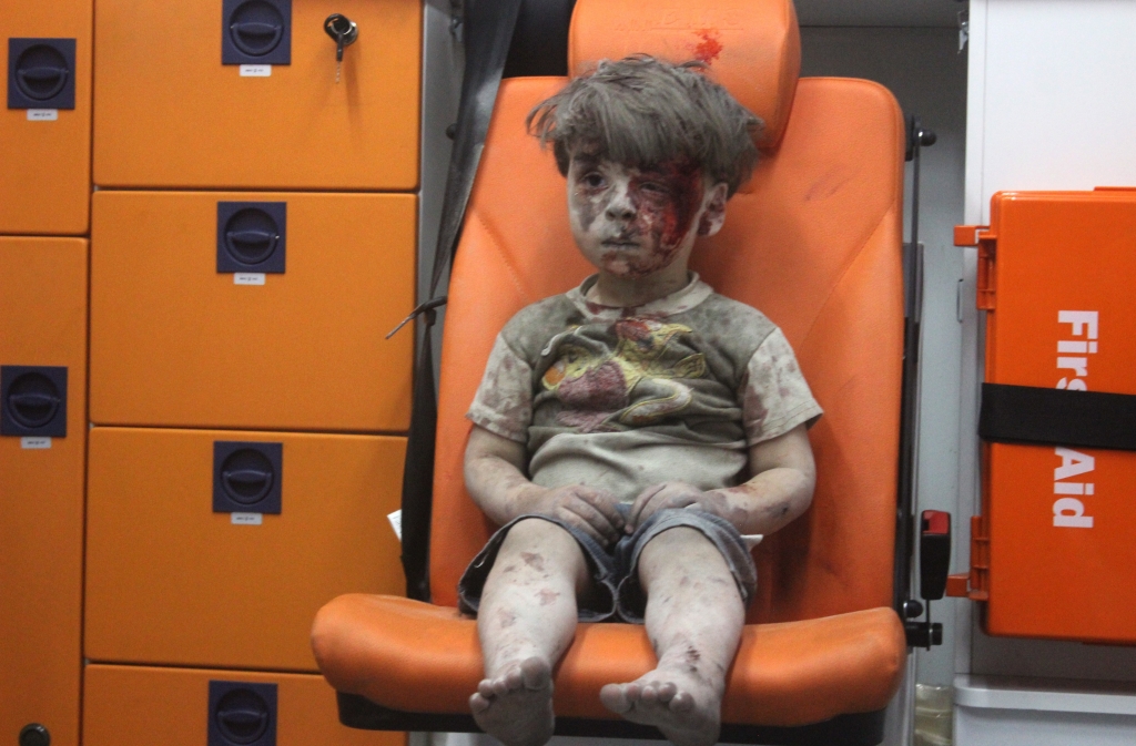 Syria conflict: Image of injured boy in Aleppo draws outrage