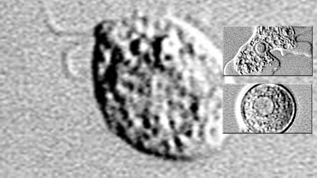 Swimmer Contracts Brain-Eating Amoeba in Broward County