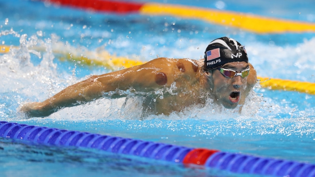 Those Weird Bruises You Keep Seeing On Michael Phelps Are All From 'Cupping'