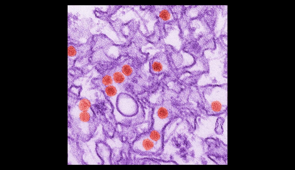 This 2016 digitally-colorized electron microscope image made available by the Centers for Disease Control and Prevention shows the Zika virus in red about 40 nanometers in diameter