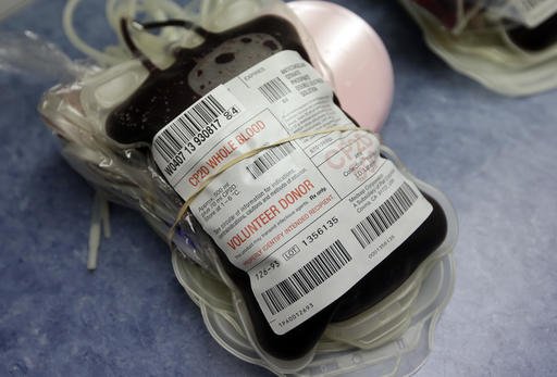 Indianapolis. On Friday Aug. 26 2016 the Food and Drug Administration recommended that all U.S. blood banks start screening for the Zika virus a major expansion intended to protect the nation