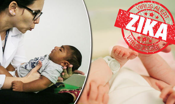 GETTYZika can cause birth defects other than microcephaly