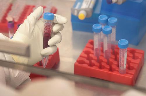 A research specialist at the University of Wisconsin Madison processes blood samples taken from pregnant rhesus macaque monkeys infected with the Zika virus