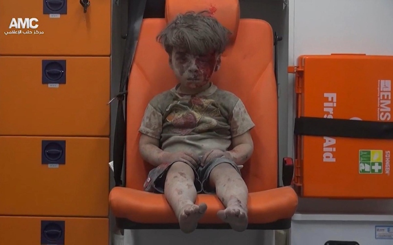 Little boy in Aleppo a vivid reminder of war's horror