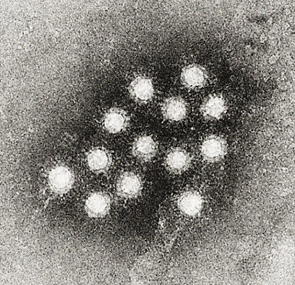 A worker at Social Kitchen & Bar was diagnosed with Hepatitis A