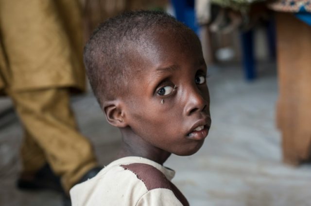 30 2016 shows a boy suffering from severe acute malnutrition sitting at one of the Unicef nutrition clinics in the outskirts of Maiduguri capital of Borno State northeastern Nigeria