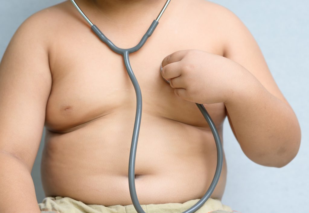 Call for robust action to tackle obesity amid reports strategy to be published