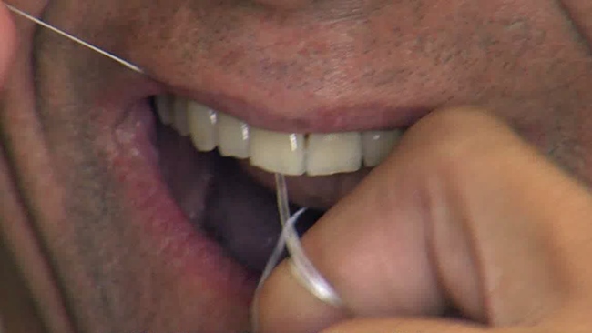 Evidence For The Benefits Of Flossing 'Weak, Very Unreliable'