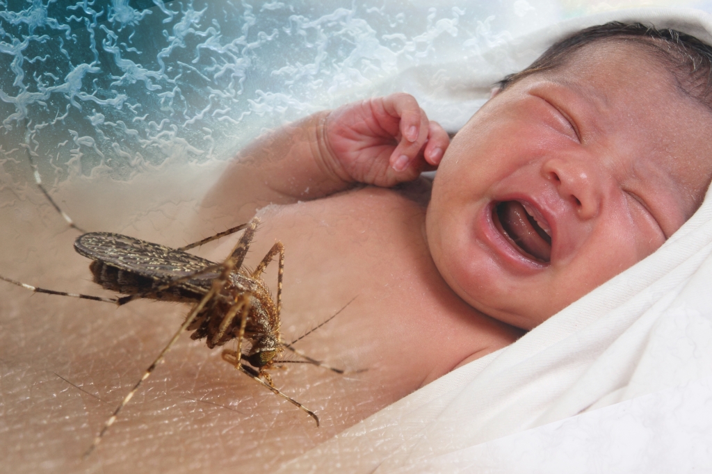 Zika virus baby