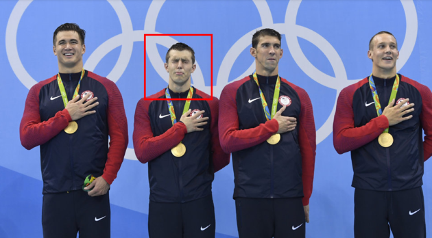 Why does Michael Phelps have purple spots on his back?