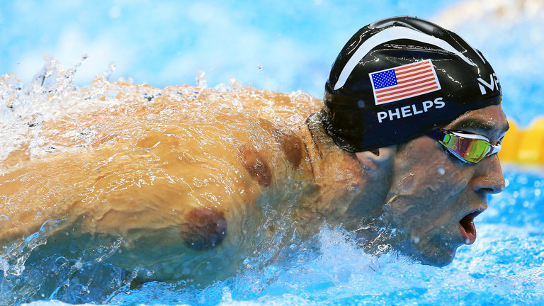 Michael Phelps&#039 right shoulder was dotted with 'cupping&#039 marks in Rio