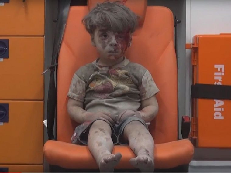 Omran Daqneesh 5 sits dazed and bloody in the backof an ambulance