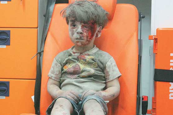 Omran was afraid and astonished and he didn’t cry because he was shocked