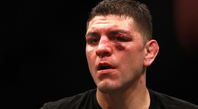 LAS VEGAS NV- JANUARY 31 Nick Diaz stands in the Octagon after five rounds against Anderson Silva in a middleweight bout during UFC 183 at the MGM Grand Garden Arena