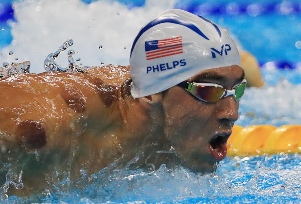 Michael Phelps of USA is seen with red cupping marks on his shoulder as he competes in the men's 200m butterfly. REUTERS  Dominic Ebenbichler