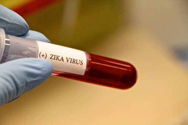 Zika-vial-getty