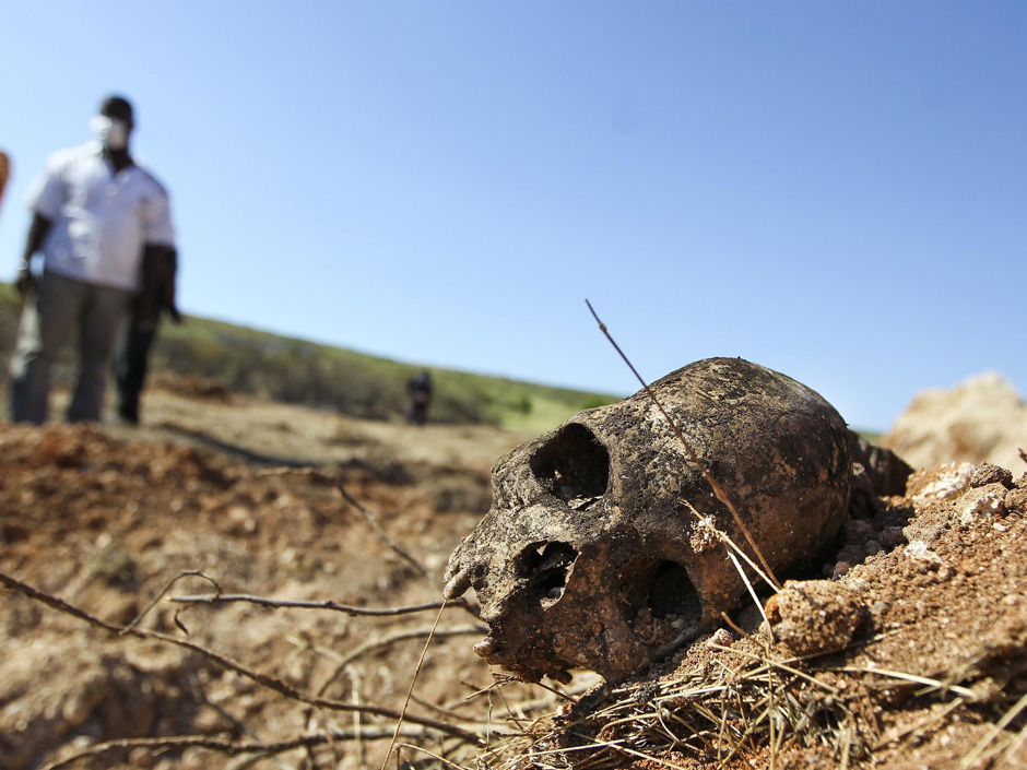 A scull is seen next to a mass grave used for cholera deaths is seen outside of Port au Prince Haiti Friday Nov 26 2010