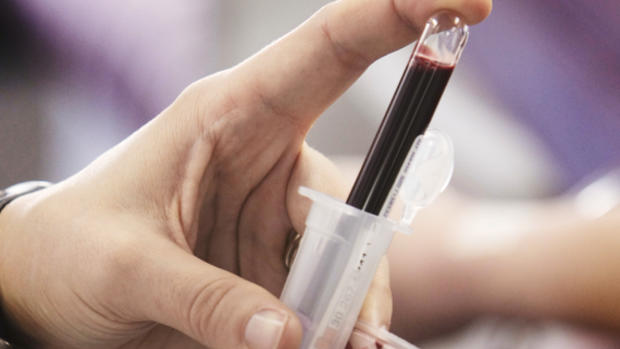 United Blood Services phlebotomist Shelleane Janssen transfers blood into test tubes. Jay Pickthorn  The Forum