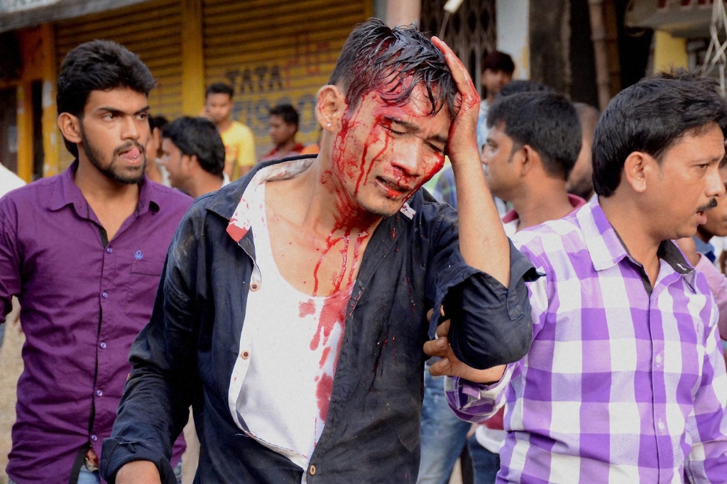 An injured member of the Indigenous People's Front of Tripura during a clash with local Bengali people following a rally in Agartala on Tuesday. The IPFT has been demanding separate statehood- Twipraland. Credit PTI