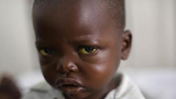 Outbreak of yellow fever in DR Congo could go global, children's charity warns