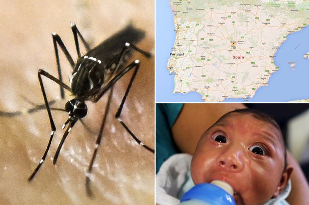 Zika baby born in Spain