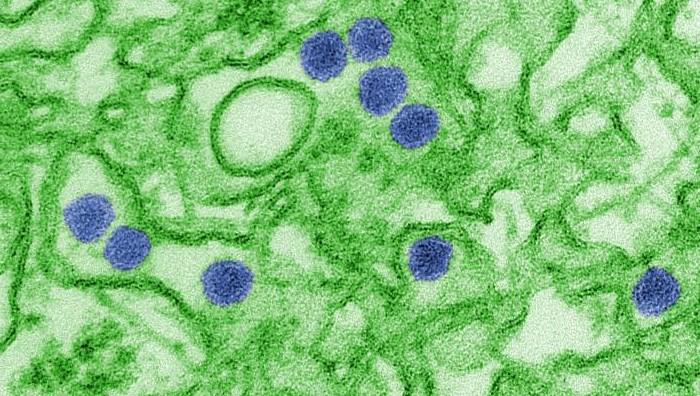 A colorized transmission electron micrograph of Zika virus   Cynthia Goldsmith  CDC. Image cropped