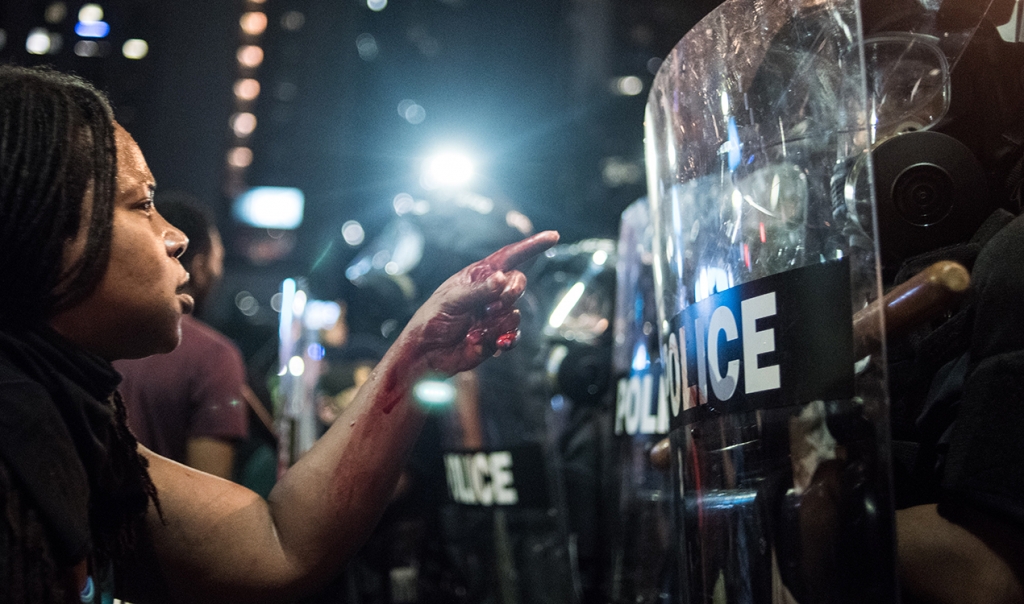 A woman with a bloodied hand points at police during a demonstration in Charlotte