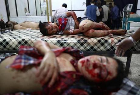 EDITORS NOTE Graphic content  Wounded Syrian children receive medical attention at a make-shift hospital following reported government air strikes on the rebel-held town of Douma east of the capital Damascus