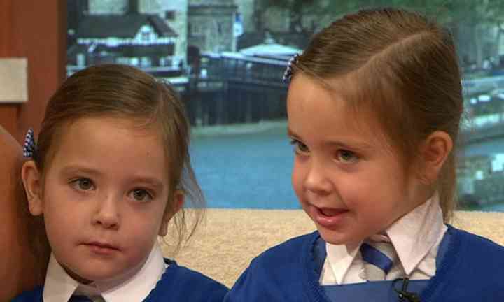 Conjoined-twins-are-thriving-and-still-share-a-special-bond