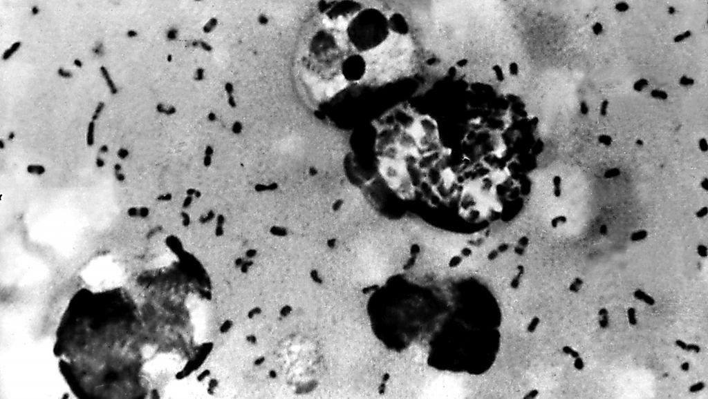 Spot on: Scientists finally pinpoint bacteria that caused the Great Plague