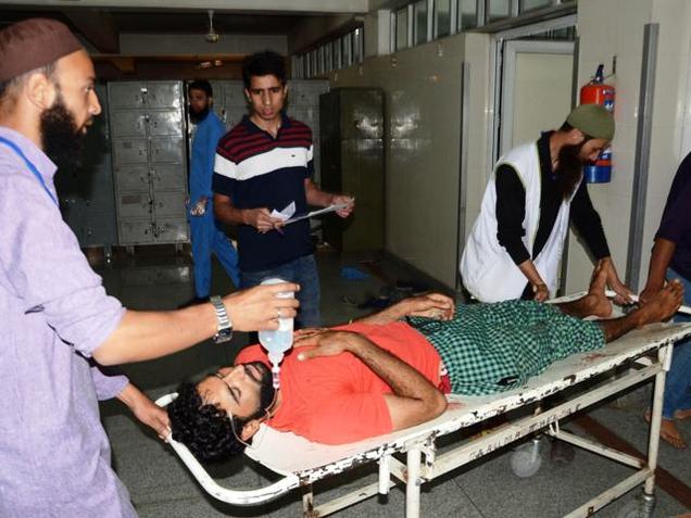 An injured man is brought to the SMHS hospital in Srinagar on Sunday