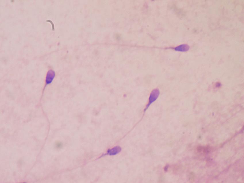 Human sperm stained for semen quality testing in the clinical laboratory. Credit Bobjgalindo  Wikipedia